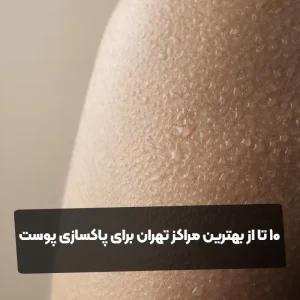 10 تا از بهترین مراکز تهران برای پاکسازی پوست