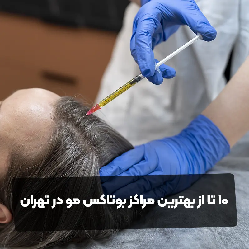 10 تا از بهترین مراکز بوتاکس مو در تهران