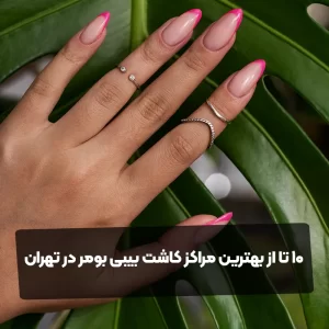 10 تا از بهترین مراکز کاشت بیبی بومر در تهران