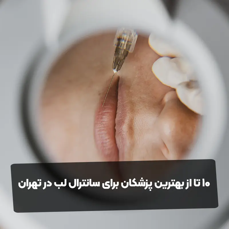 10 تا از بهترین پزشکان برای سانترال لب در تهران